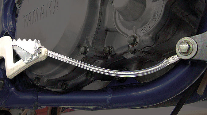 Pedal Anchor Kit